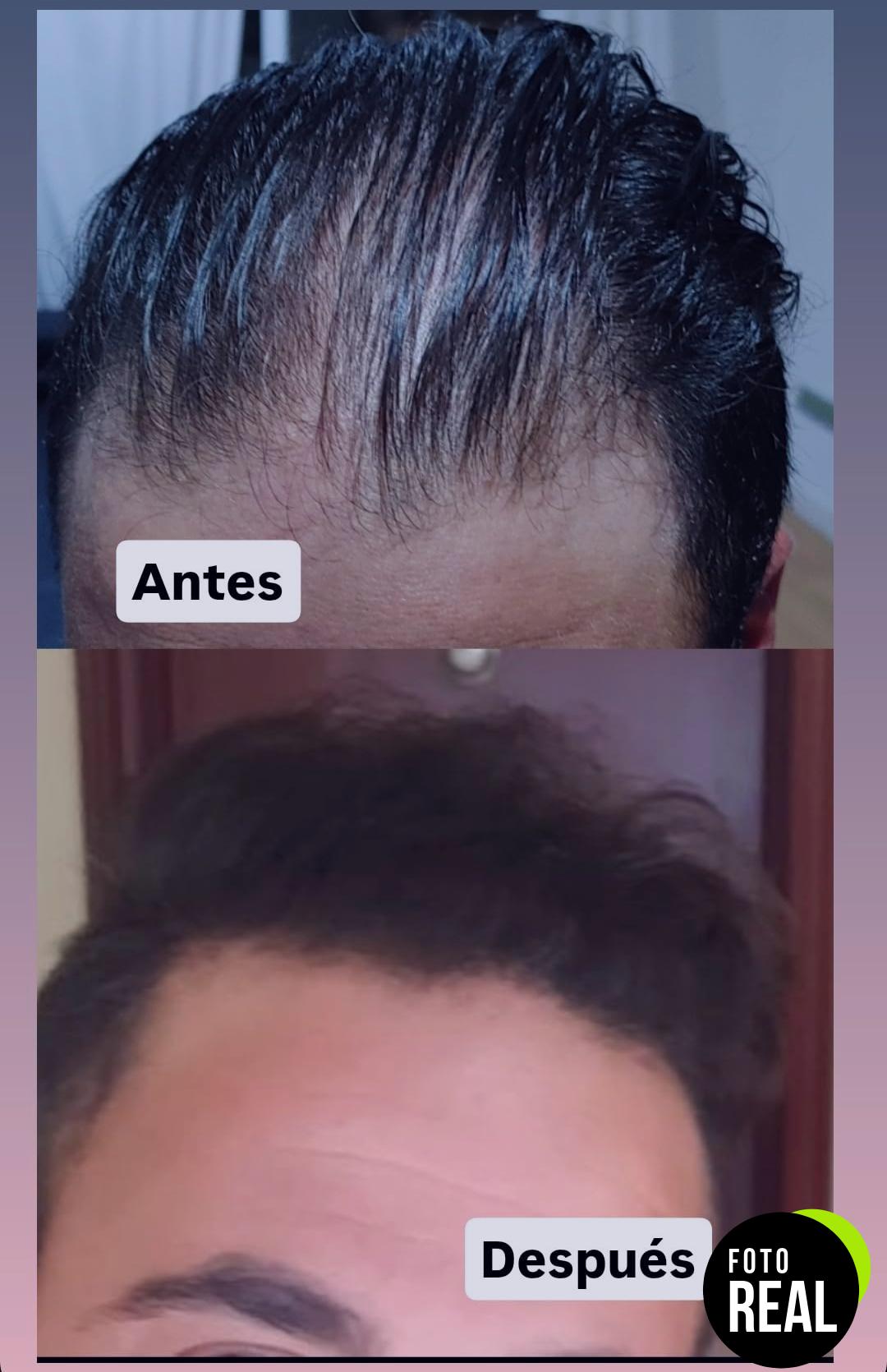 fibras-capilares-negro-spray-275g-foto-1
